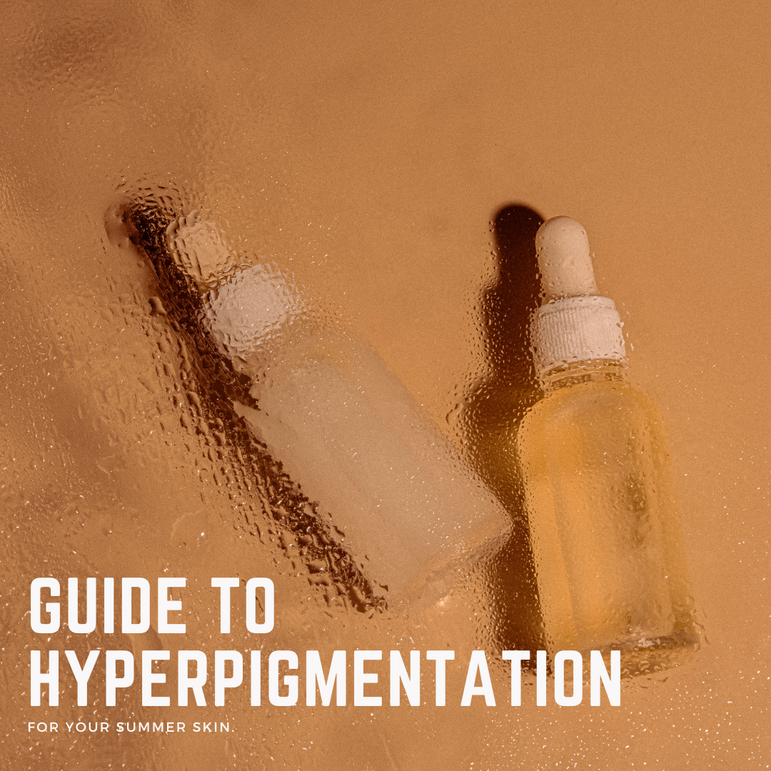 how to manage hyperpigmentation in summer blog image viederma